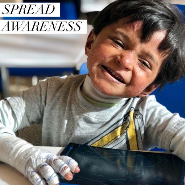 Epidermolysis Bullosa Awareness